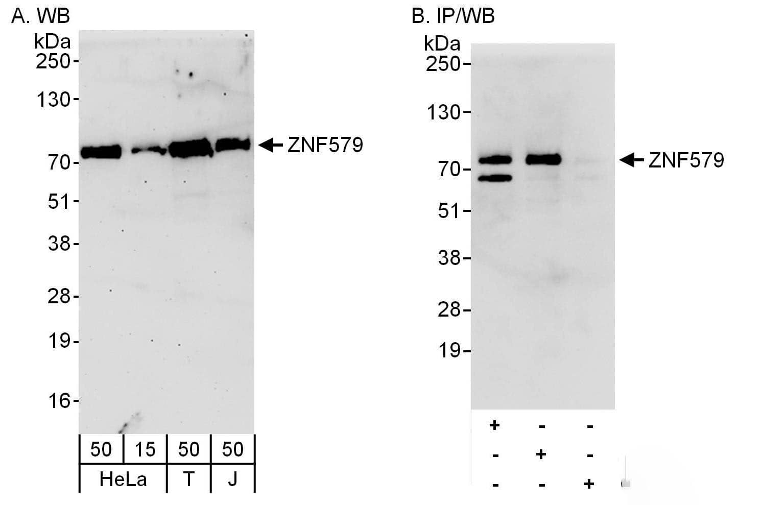 Western Blot ZNF579 Antibody - BSA Free