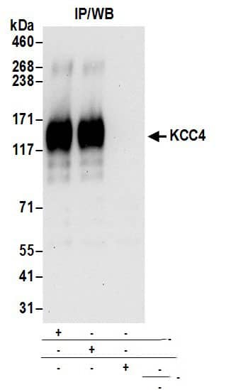 Immunoprecipitation:[NBP3-30033]-Detection of human KCC4 by western blot of immunoprecipitates. Samples: Whole cell lysate prepared using NETN buffer from Jurkat cells. Antibodies: Affinity purified rabbit anti-KCC4 antibody used for IP at 6 µg per reaction. KCC4 was also immunoprecipitated by rabbit anti-KCC4 antibody. For blotting immunoprecipitated KCC4, was used at 0. 4 µg/ml. Detection: Chemiluminescence with an exposure time of 30 seconds.