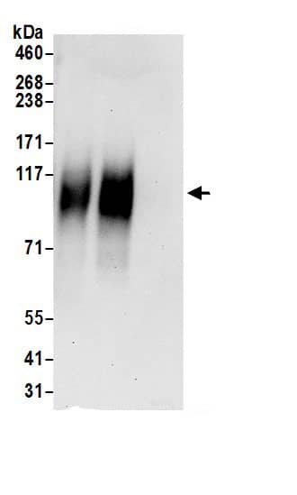 Immunoprecipitation:SLC26A2 AntibodyNBP3-30034] -Detection of human SLC26A2 by western blot of immunoprecipitates. Samples: Whole cell lysate (0.5 or 1.0 mg per IP reaction; 20% of IP loaded) from HeLa cells prepared using RIPA lysis buffer. Antibodies: Affinity purified rabbit anti-SLC26A2 antibody NBP3-30034 (lot NBP3-30034-1) used for IP at 6 µg per reaction. SLC26A2 was also immunoprecipitated by rabbit anti-SLC26A2.. For blotting immunoprecipitated SLC26A2, NBP3-30034 was used at 1 µg/ml. Detection: Chemiluminescence with an exposure time of 3 minutes.