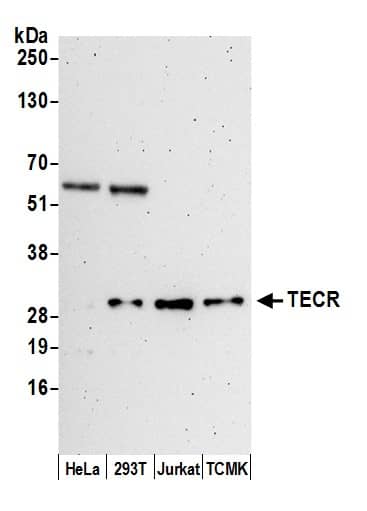 Western Blot:[NBP3-30036]-Detection of human and mouse TECR by western blot. Samples: Whole cell lysate from HeLa, HEK293T, Jurkat, and mouse TCMK-1, cells prepared using NETN lysis buffer. Antibody: Affinity purified rabbit anti-TECR antibody used for WB at 0. 1 µg/ml. Detection: Chemiluminescence with an exposure time of 3 minutes.