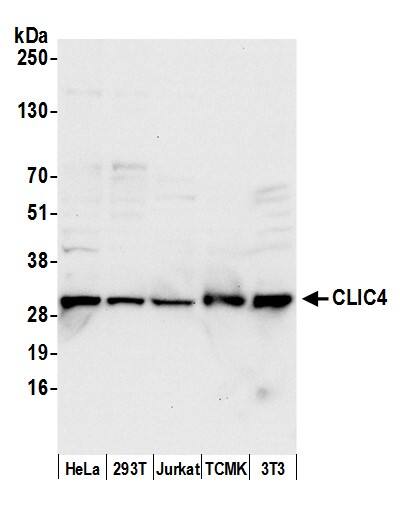 Western Blot:[NBP3-30037]-Detection of human and mouse CLIC4 by western blot. Samples: Whole cell lysate from HeLa, HEK293T, Jurkat, mouse TCMK-1, and mouse NIH 3T3 cells prepared using NETN lysis buffer. Antibody: Affinity purified rabbit anti-CLIC4 antibody used for WB at 0. 1 µg/ml. Detection: Chemiluminescence with an exposure time of 10 seconds.