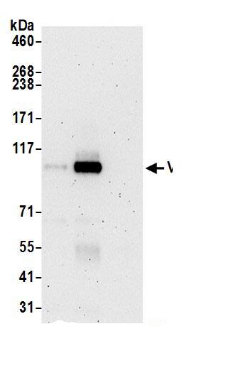 Immunoprecipitation:VPS18 AntibodyNBP3-30039] -Detection of human VPS18 by western blot of immunoprecipitates. Samples: Whole cell lysate (0.5 or 1.0 mg per IP reaction; 20% of IP loaded) from 293T cells prepared using NETN lysis buffer. Antibodies: Affinity purified rabbit anti-VPS18 antibody NBP3-30039 (lot NBP3-30039-1) used for IP at 6 µg per reaction. VPS18 was also immunoprecipitated by rabbit anti-VPS18.. For blotting immunoprecipitated VPS18, NBP3-30039 was used at 1 µg/ml. Detection: Chemiluminescence with an exposure time of 3 minutes.