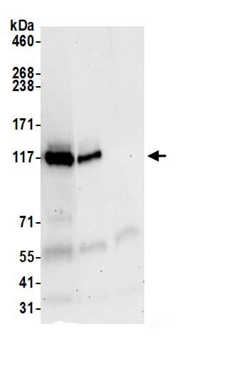 Immunoprecipitation:FAM29A AntibodyNBP3-30041] -Detection of human HAUS6 by western blot of immunoprecipitates. Samples: Whole cell lysate (0.5 or 1.0 mg per IP reaction; 20% of IP loaded) from Jurkat cells prepared using NETN lysis buffer. Antibodies: Affinity purified rabbit anti-HAUS6 antibody NBP3-30041 (lot NBP3-30041-1) used for IP at 6 µg per reaction. HAUS6 was also immunoprecipitated by rabbit anti-HAUS6.. For blotting immunoprecipitated HAUS6, NBP3-30041 was used at 1 µg/ml. Detection: Chemiluminescence with an exposure time of 30 seconds.