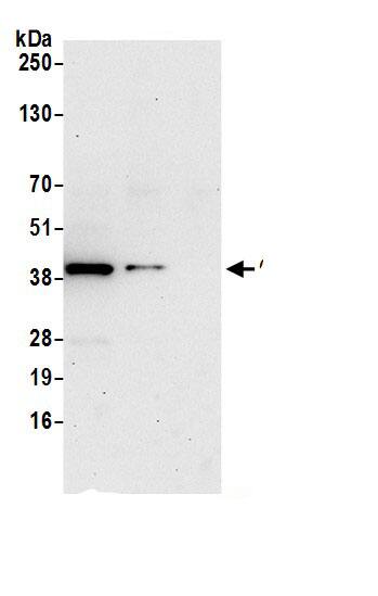 Immunoprecipitation:CapG AntibodyNBP3-30045] -Detection of human CAPG by western blot of immunoprecipitates. Samples: Whole cell lysate (0.5 or 1.0 mg per IP reaction; 20% of IP loaded) from Jurkat cells prepared using NETN lysis buffer. Antibodies: Affinity purified rabbit anti-CAPG antibody NBP3-30045 (lot NBP3-30045-1) used for IP at 6 µg per reaction. CAPG was also immunoprecipitated by rabbit anti-CAPG antibody. For blotting immunoprecipitated CAPG, NBP3-30045 was used at 0.4 µg/ml. Detection: Chemiluminescence with an exposure time of 30 seconds.
