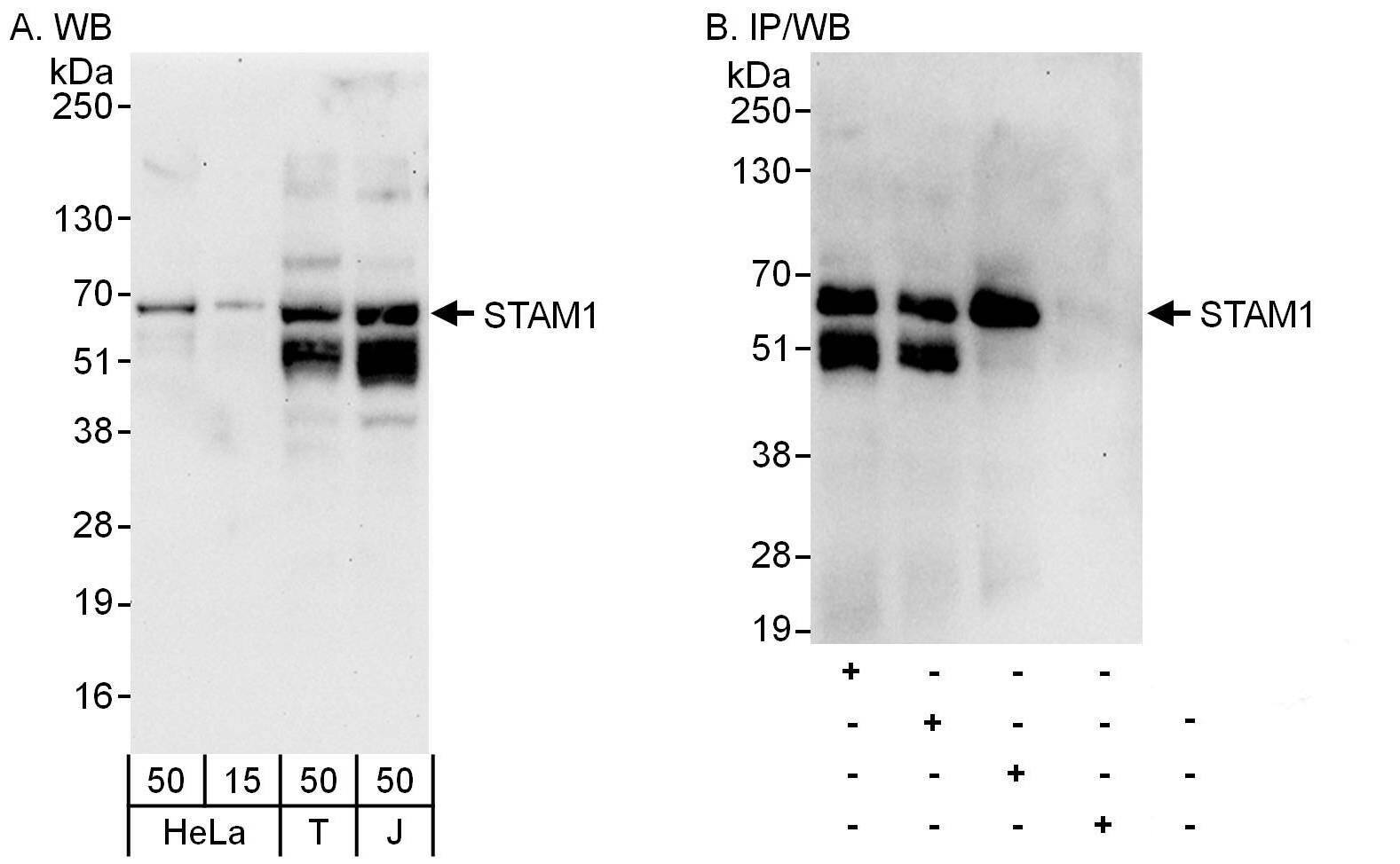 Western Blot:[NBP3-30047]-Detection of human STAM1 by western blot and immunoprecipitation. Samples: Whole cell lysate from HeLa , HEK293T and Jurkat cells. Antibodies: Affinity purified rabbit anti-STAM1 antibody used for WB at 0. 04 µg/ml and 1 µg/ml and used for IP at 6 µg/mg lysate. STAM1 was also immunoprecipitated by rabbit anti-STAM1 antibodies and , which recognize downstream epitopes. Detection: Chemiluminescence with exposure times of 30 seconds and 10 seconds.