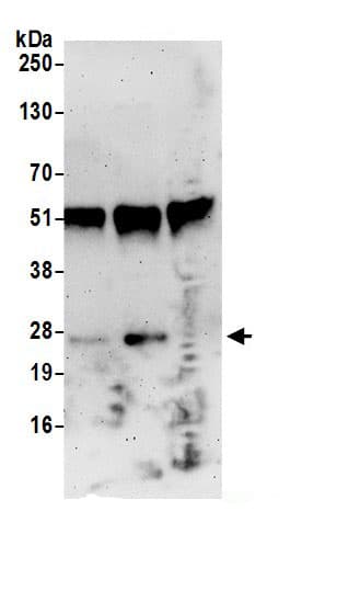 Immunoprecipitation:RPP25 AntibodyNBP3-30048] -Detection of human RPP25 by western blot of immunoprecipitates. Samples: Whole cell lysate (0.5 or 1.0 mg per IP reaction; 20% of IP loaded) from HeLa cells prepared using NETN lysis buffer. Antibodies: Affinity purified rabbit anti-RPP25 antibody NBP3-30048 (lot NBP3-30048-1) used for IP at 6 µg per reaction. RPP25 was also immunoprecipitated by rabbit anti-RPP25 antibody BL20252. For blotting immunoprecipitated RPP25, NBP3-30048 was used at 1 µg/ml. Detection: Chemiluminescence with an exposure time of 3 minutes.