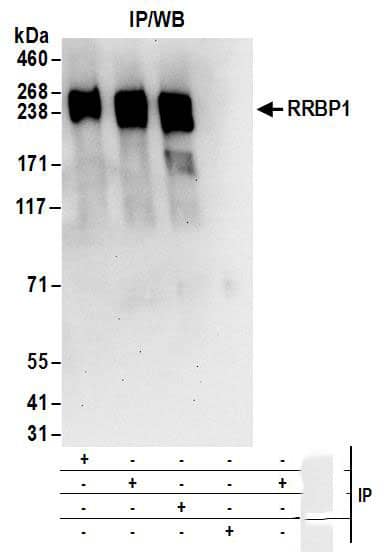 Immunoprecipitation:[NBP3-30049]-Detection of human RRBP1 by western blot of immunoprecipitates. Samples: Whole cell lysate from HeLa cells. Antibodies: Affinity purified rabbit anti-RRBP1 antibody used for IP at 6 µg/mg lysate. RRBP1 was also immunoprecipitated by rabbit anti-RRBP1 antibodies and. For blotting immunoprecipitated RRBP1, was used at 1 µg/ml. Detection: Chemiluminescence with an exposure time of 30 seconds.