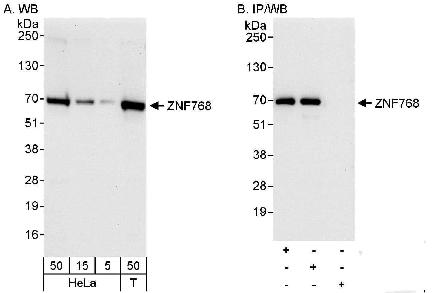 Western Blot:[NBP3-30050]-Detection of human ZNF768 by western blot and immunoprecipitation. Samples: Whole cell lysate from HeLa and HEK293T cells. Antibodies: Affinity purified rabbit anti-ZNF768 antibody used for WB at 0. 1 µg/ml and 1 µg/ml and used for IP at 10 µg/mg lysate. ZNF768 was also immunoprecipitated by rabbit anti-ZNF768 antibody , which recognizes an upstream epitope. Detection: Chemiluminescence with exposure times of 30 seconds and 10 seconds.