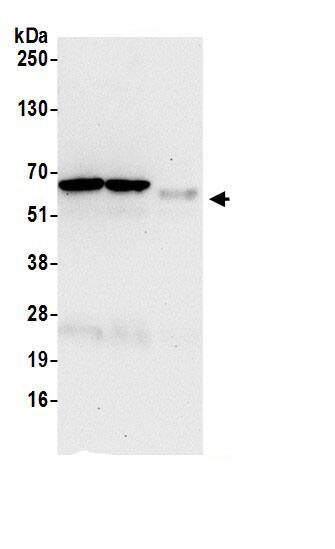 Immunoprecipitation:IF3EI AntibodyNBP3-30051] -Detection of human EIF3L by western blot of immunoprecipitates. Samples: Whole cell lysate (0.5 or 1.0 mg per IP reaction; 20% of IP loaded) from 293T cells prepared using NETN lysis buffer. Antibodies: Affinity purified rabbit anti-EIF3L antibody NBP3-30051 (lot NBP3-30051-1) used for IP at 6 µg per reaction. EIF3L was also immunoprecipitated by rabbit anti-EIF3L.. For blotting immunoprecipitated EIF3L, NBP3-30051 was used at 0.4 µg/ml. Detection: Chemiluminescence with an exposure time of 30 seconds.