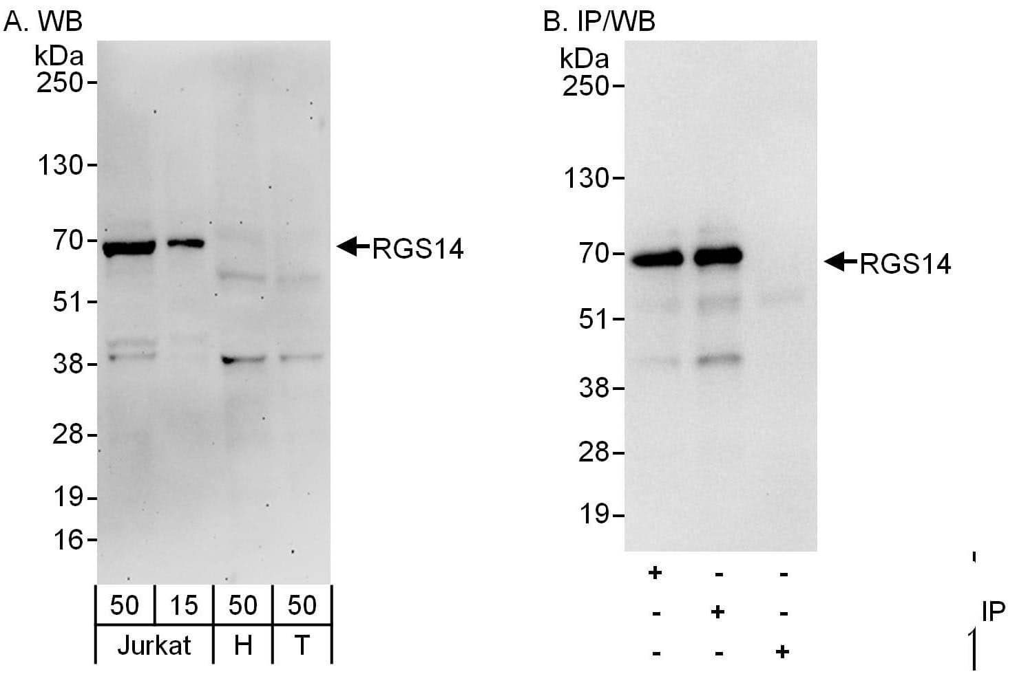 Western Blot:[NBP3-30053]-Detection of human RGS14 by western blot and immunoprecipitation. Samples: Whole cell lysate from Jurkat , HeLa and HEK293T cells. Antibodies: Affinity purified rabbit anti-RGS14 antibody used for WB at 0. 1 µg/ml and 1 µg/ml and used for IP at 6 µg/mg lysate. RGS14 was also immunoprecipitated by rabbit anti-RGS14 antibody , which recognizes an upstream epitope. Detection: Chemiluminescence with exposure times of 3 minutes and 10 seconds.