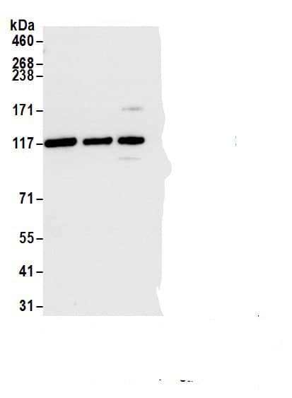 Immunoprecipitation:ARS2 AntibodyNBP3-30056] -Detection of human ARS2 by western blot of immunoprecipitates. Samples: Whole cell lysate (1.0 mg per IP reaction; 20% of IP loaded) from Hela cells prepared using NETN lysis buffer. Antibodies: Affinity purified rabbit anti-ARS2 antibody NBP3-30056 (lot NBP3-30056-3) used for IP at 6 µg per reaction. ARS2 was also immunoprecipitated by a previous lot of this antibody (lot NBP3-30056-1) and rabbit anti-ARS2. For blotting immunoprecipitated ARS2, NBP3-30056 was used at 0.04 µg/ml. Detection: Chemiluminescence with an exposure time of 3 seconds.