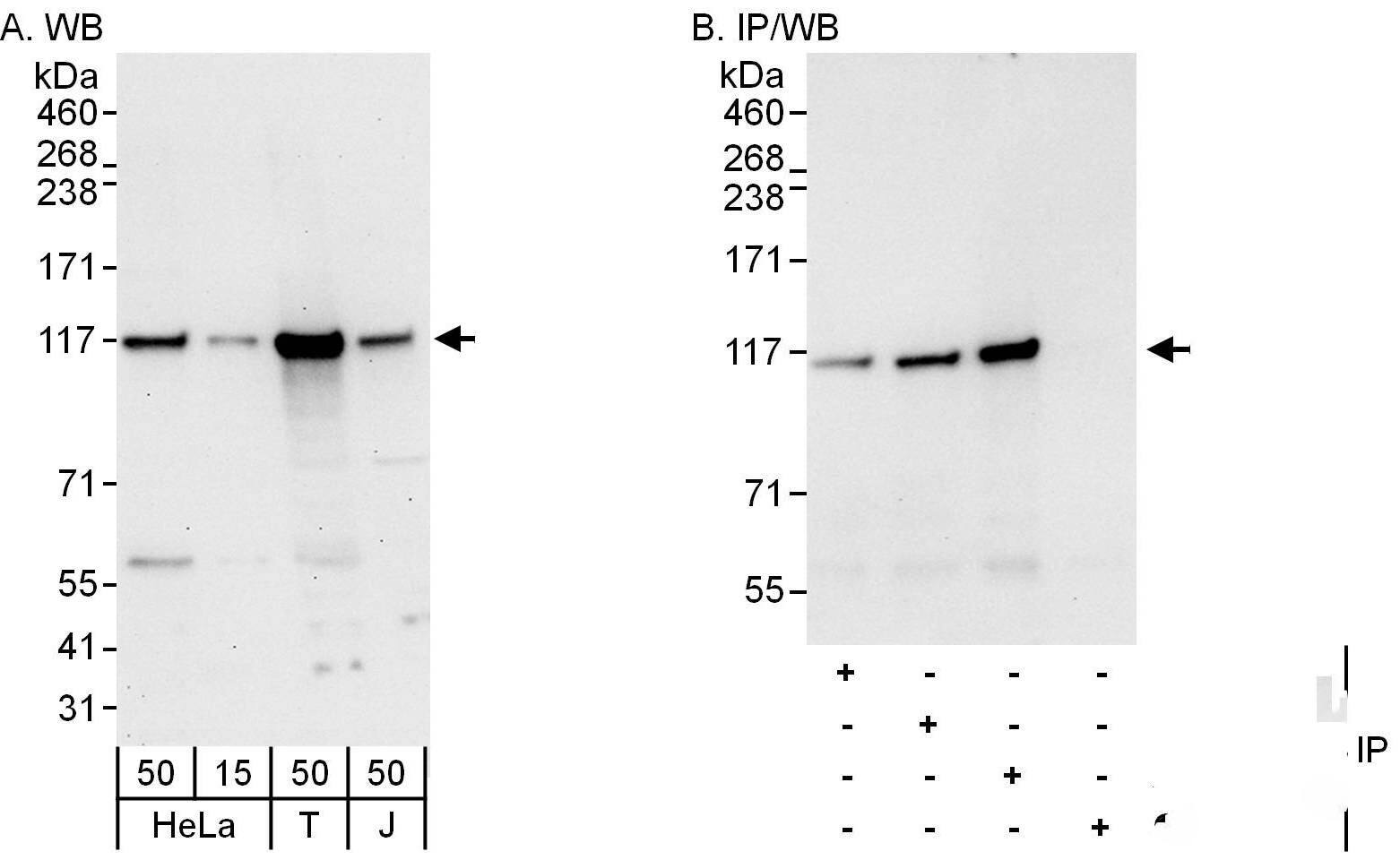 Western Blot:[NBP3-30060]-Detection of human DIS3 by western blot and immunoprecipitation. Samples: Whole cell lysate from HeLa , HEK293T and Jurkat cells. Antibodies: Affinity purified rabbit anti-DIS3 antibody used for WB at 0. 1 µg/ml and 1 µg/ml and used for IP at 6 µg/mg lysate. DIS3 was also immunoprecipitated by rabbit anti-DIS3 antibodies and , which recognize upstream epitopes. Detection: Chemiluminescence with exposure times of 30 seconds and 10 seconds.