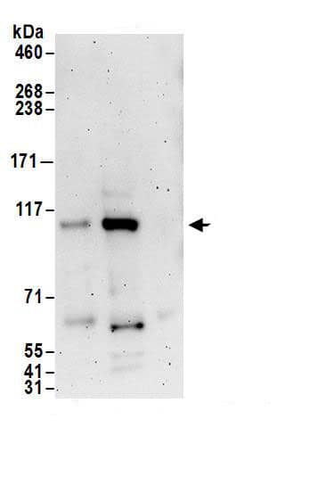 Immunoprecipitation:Exportin-T AntibodyNBP3-30061] -Detection of human Exportin-T by western blot of immunoprecipitates. Samples: Whole cell lysate (1 mg for IP; 20% of IP loaded) from HEK293T cells. Antibodies: Affinity purified rabbit anti-Exportin-T antibody NBP3-30061 (lot NBP3-30061-1) used for IP at 6 µg/mg lysate. Exportin-T was inefficiently immunoprecipitated by rabbit anti-Exportin-T.. For blotting immunoprecipitated Exportin-T, NBP3-30061 was used at 1 µg/ml. Detection: Chemiluminescence with an exposure time of 3 minutes.