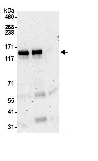 Immunoprecipitation:NBR1 AntibodyNBP3-30062] -Detection of human NBR1 by western blot of immunoprecipitates. Samples: Whole cell lysate (0.5 or 1.0 mg per IP reaction; 20% of IP loaded) from HeLa cells prepared using NETN lysis buffer. Antibodies: Affinity purified rabbit anti-NBR1 antibody NBP3-30062 (lot NBP3-30062-1) used for IP at 6 µg per reaction. NBR1 was also immunoprecipitated by rabbit anti-NBR1 antibody BL20830. For blotting immunoprecipitated NBR1, NBP3-30062 was used at 1 µg/ml. Detection: Chemiluminescence with an exposure time of 3 minutes.