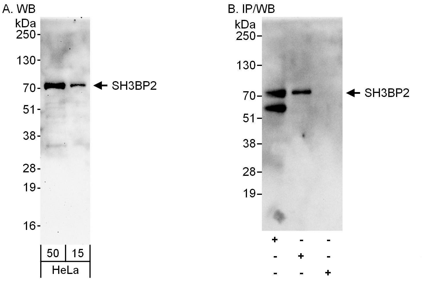 Western Blot:[NBP3-30064]-Detection of human SH3BP2 by western blot and immunoprecipitation. Samples: Whole cell lysate from HeLa cells. Antibodies: Affinity purified rabbit anti-SH3BP2 antibody used for WB at 0. 1 µg/ml and 1 µg/ml and used for IP at 6 µg/mg lysate. SH3BP2 was also immunoprecipitated by rabbit anti-SH3BP2 antibody , which recognizes a downstream epitope. Detection: Chemiluminescence with exposure times of 3 minutes and 10 seconds.