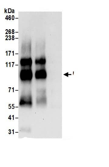 Immunoprecipitation:Endoglycan/PODXL2 AntibodyNBP3-30066] -Detection of human Endoglycan by western blot of immunoprecipitates. Samples: Whole cell lysate (0.5 or 1.0 mg per IP reaction; 20% of IP loaded) from HeLa cells prepared using RIPA lysis buffer. Antibodies: Affinity purified rabbit anti-Endoglycan antibody NBP3-30066 (lot NBP3-30066-1) used for IP at 6 µg per reaction. Endoglycan was also immunoprecipitated by rabbit anti-Endoglycan antibody. For blotting immunoprecipitated Endoglycan, NBP3-30066 was used at 1 µg/ml. Detection: Chemiluminescence with an exposure time of 30 seconds.