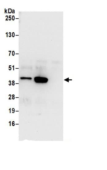 Immunoprecipitation:STRAP AntibodyNBP3-30067] -Detection of human STRAP by western blot of immunoprecipitates. Samples: Whole cell lysate (0.5 or 1.0 mg per IP reaction; 20% of IP loaded) from 293T cells prepared using NETN lysis buffer. Antibodies: Affinity purified rabbit anti-STRAP antibody NBP3-30067 (lot NBP3-30067-1) used for IP at 6 µg per reaction. STRAP was also immunoprecipitated by rabbit anti-STRAP antibody BL18472. For blotting immunoprecipitated STRAP, NBP3-30067 was used at 0.4 µg/ml. Detection: Chemiluminescence with an exposure time of 10 seconds.