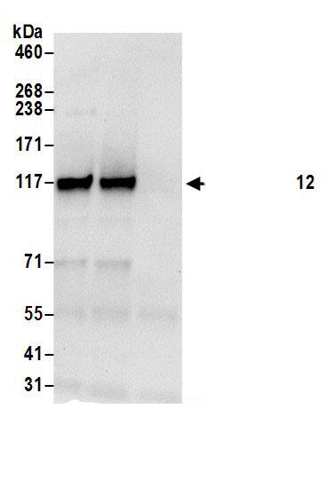 Immunoprecipitation:HIP1 Related AntibodyNBP3-30068] -Detection of human HIP1R/HIP12 by western blot of immunoprecipitates. Samples: Whole cell lysate (0.5 or 1.0 mg per IP reaction; 20% of IP loaded) from 293T cells prepared using NETN lysis buffer. Antibodies: Affinity purified rabbit anti-HIP1R/HIP12 antibody NBP3-30068 (lot NBP3-30068-1) used for IP at 6 µg per reaction. HIP1R/HIP12 was also immunoprecipitated by rabbit anti-HIP1R/HIP12.. For blotting immunoprecipitated HIP1R/HIP12, NBP3-30068 was used at 0.4 µg/ml. Detection: Chemiluminescence with an exposure time of 10 seconds.