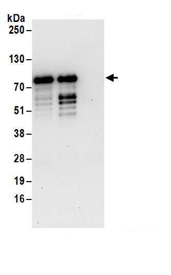 Immunoprecipitation:ZNF358 AntibodyNBP3-30069] -Detection of human ZNF358 by western blot of immunoprecipitates. Samples: Whole cell lysate (1 mg for IP; 20% of IP loaded) from 293T cells. Antibodies: Affinity purified rabbit anti-ZNF358 antibody NBP3-30069 (lot NBP3-30069-1) used for IP at 6 µg/mg lysate. ZNF358 was also immunoprecipitated by rabbit anti-ZNF358.. For blotting immunoprecipitated ZNF358, NBP3-30069 was used at 1 µg/ml. Detection: Chemiluminescence with an exposure time of 30 seconds.