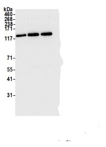 Immunoprecipitation IWS1 Antibody