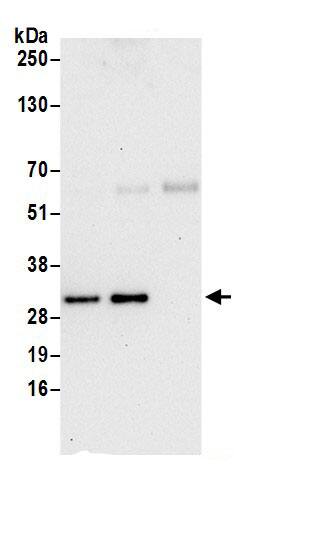 Immunoprecipitation:BLOS3 AntibodyNBP3-30074] -Detection of human BLOC1S3 by western blot of immunoprecipitates. Samples: Whole cell lysate (0.5 or 1.0 mg per IP reaction; 20% of IP loaded) from 293T cells prepared using NETN lysis buffer. Antibodies: Affinity purified rabbit anti-BLOC1S3 antibody NBP3-30074 (lot NBP3-30074-1) used for IP at 6 µg per reaction. BLOC1S3 was also immunoprecipitated by rabbit anti-BLOC1S3 antibody BL17617. For blotting immunoprecipitated BLOC1S3, NBP3-30074 was used at 1 µg/ml. Detection: Chemiluminescence with an exposure time of 30 seconds.