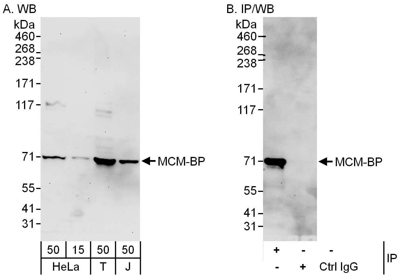 Western Blot:[NBP3-30075]-Detection of human MCM-BP by western blot and immunoprecipitation. Samples: Whole cell lysate from HeLa , HEK293T and Jurkat cells. Antibodies: Affinity purified rabbit anti-MCM-BP antibody used for WB at 0. 1 µg/ml and 1 µg/ml and used for IP at 6 µg/mg lysate. Detection: Chemiluminescence with exposure times of 3 minutes and 30 seconds.
