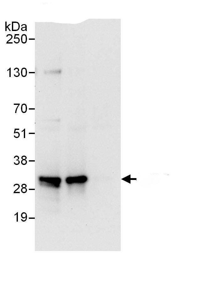 Immunoprecipitation:PSMF1 AntibodyNBP3-30076] -Detection of human PSMF1 by western blot of immunoprecipitates. Samples: Whole cell lysate (1 mg for IP; 20% of IP loaded) from HEK293T cells. Antibodies: Affinity purified rabbit anti-PSMF1 antibody NBP3-30076 (lot NBP3-30076-1) used for IP at 6 µg/mg lysate. PSMF1 was also immunoprecipitated by rabbit anti-PSMF1.. For blotting immunoprecipitated PSMF1, NBP3-30076 was used at 0.4 µg/ml. Detection: Chemiluminescence with an exposure time of 10 seconds.