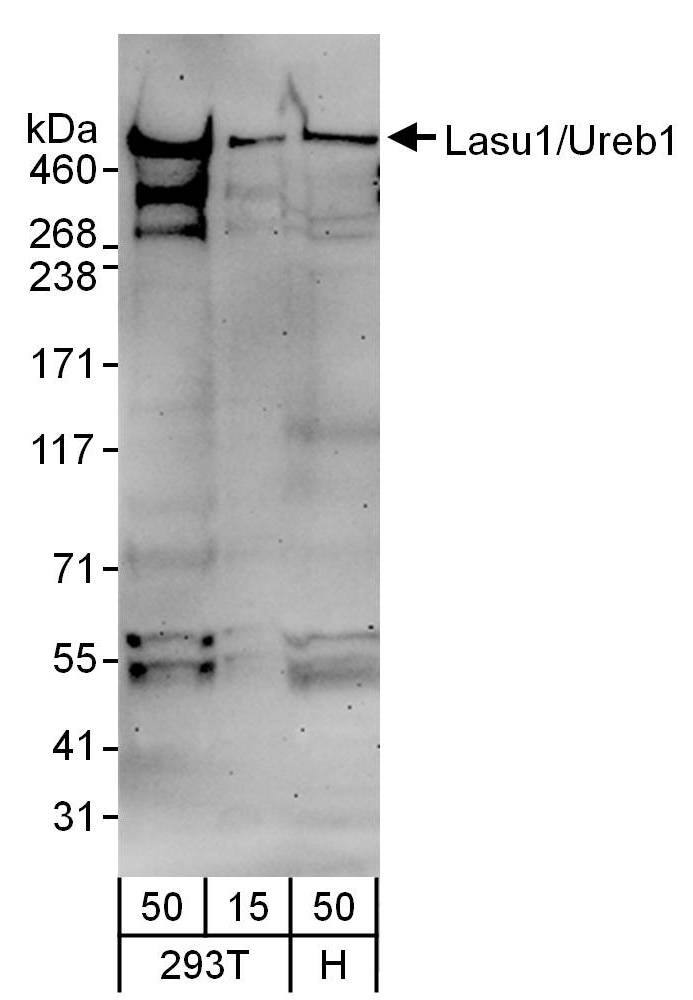 Western Blot:[NBP3-30079]-Detection of human Lasu1/Ureb1 by western blot. Samples: Whole cell lysate from HEK293T and HeLa cells. Antibodies: Affinity purified goat anti-Lasu1/Ureb1 antibody used for WB at 1 µg/ml. Detection: Chemiluminescence with an exposure time of 3 minutes.