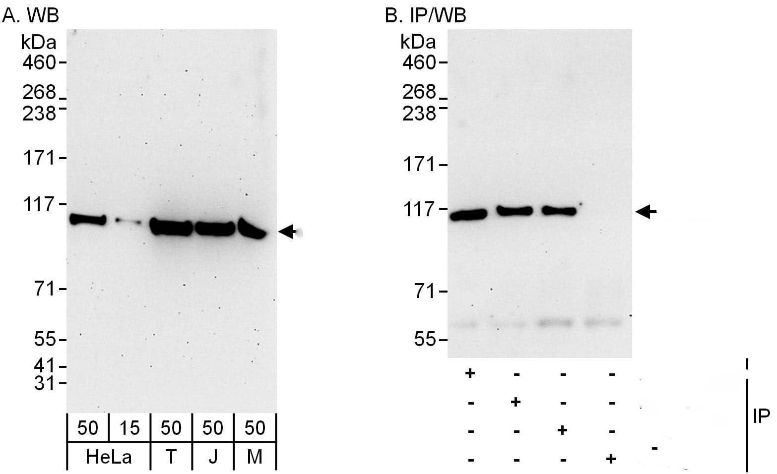 Western Blot:[NBP3-30081]-Detection of human and mouse AARS by western blot and immunoprecipitation. Samples: Whole cell lysate from HeLa , HEK293T , Jurkat and mouse NIH 3T3 cells. Antibodies: Affinity purified rabbit anti-AARS antibody used for WB at 0. 04 µg/ml and 0. 4 µg/ml and used for IP at 6 µg/mg lysate. AARS was also immunoprecipitated by rabbit anti-AARS antibodies and , which recognize upstream epitopes. Detection: Chemiluminescence with exposure times of 3 minutes and 30 seconds.