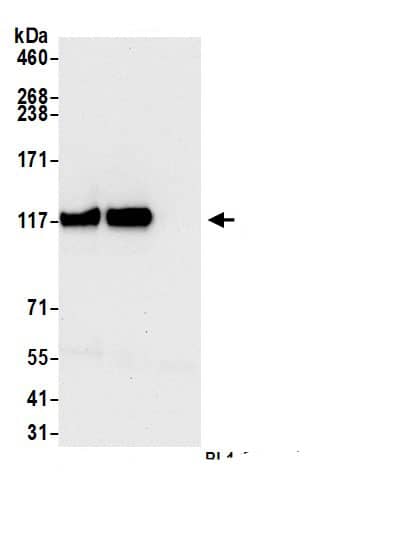 Immunoprecipitation:GEM Interacting Protein AntibodyNBP3-30082] -Detection of human GMIP by western blot of immunoprecipitates. Samples: Whole cell lysate (1.0 mg per IP reaction; 20% of IP loaded) from Jurkat cells prepared using NETN lysis buffer. Antibodies: Affinity purified rabbit anti-GMIP antibody (NBP3-30082 lot 1) used for IP at 1 µg per reaction. GMIP was also immunoprecipitated by rabbit anti-GMIP antibody. For blotting immunoprecipitated GMIP, NBP3-30082 was used at 0.04 mg/ml. Detection: Chemiluminescence with an exposure time of 10 seconds.