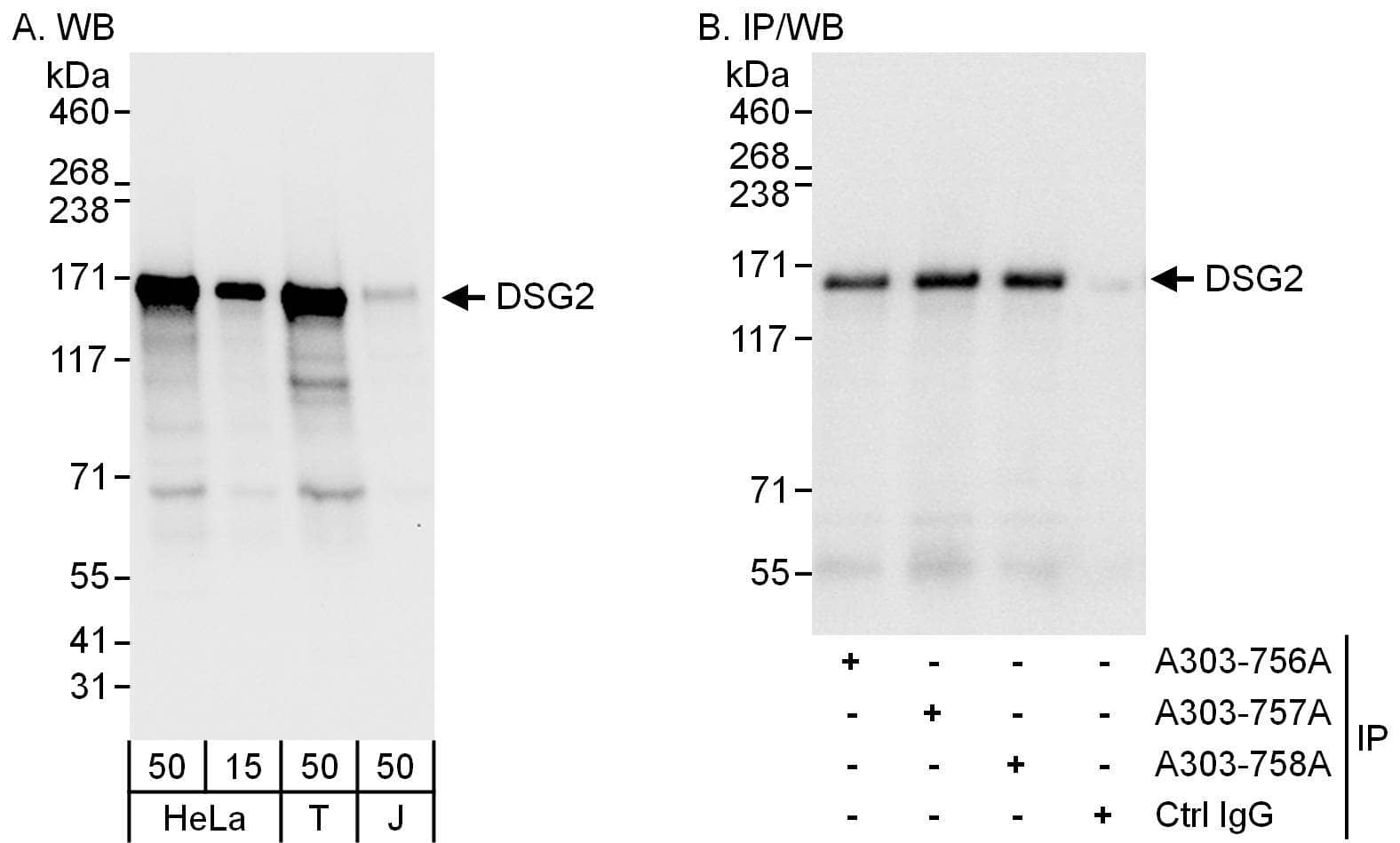 Western Blot:[NBP3-30084]-Detection of human DSG2 by western blot and immunoprecipitation. Samples: Whole cell lysate from HeLa , HEK293T and Jurkat cells. Antibodies: Affinity purified rabbit anti-DSG2 antibody used for WB at 0. 1 µg/ml and 1 µg/ml and used for IP at 6 µg/mg lysate. DSG2 was also immunoprecipitated by rabbit anti-DSG2 antibodies and , which recognize other epitopes. Detection: Chemiluminescence with exposure times of 3 seconds and 1 seconds.