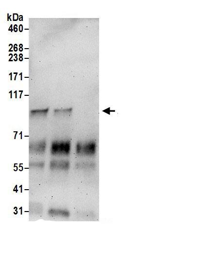 Immunoprecipitation:Importin 11 AntibodyNBP3-30085] -Detection of human Importin 11/IPO11 by western blot of immunoprecipitates. Samples: Whole cell lysate (0.5 or 1.0 mg per IP reaction; 20% of IP loaded) from 293T cells prepared using NETN lysis buffer. Antibodies: Affinity purified rabbit anti-Importin 11/IPO11 antibody NBP3-30085 (lot NBP3-30085-1) used for IP at 6 µg per reaction. Importin 11/IPO11 was also immunoprecipitated by rabbit anti-Importin 11/IPO11.. For blotting immunoprecipitated Importin 11/IPO11, NBP3-30085 was used at 0.4 µg/ml. Detection: Chemiluminescence with an exposure time of 3 minutes.