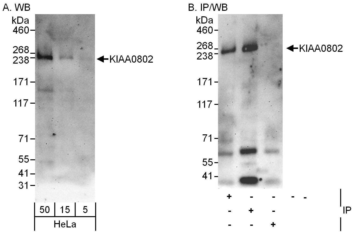 Immunoprecipitation:[NBP3-30086]-Detection of human KIAA0802 by western blot of immunoprecipitates. Samples: Whole cell lysate from HeLa cells. Antibodies: Affinity purified rabbit anti-KIAA0802 antibody used for IP at 10 µg/mg lysate. KIAA0802 was also immunoprecipitated by rabbit anti-KIAA0802 antibody , which recognizes a downstream epitope. For blotting immunoprecipitated KIAA0802, was used at 1 µg/ml. Detection: Chemiluminescence with an exposure time of 3 minutes.