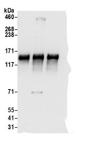 Immunoprecipitation:SEC24B AntibodyNBP3-30087] -Detection of human SEC24B by western blot of immunoprecipitates. Samples: Whole cell lysate (0.5 or 1.0 mg per IP reaction; 20% of IP loaded) from 293T cells prepared using NETN lysis buffer. Antibodies: Affinity purified rabbit anti-SEC24B antibody NBP3-30087 (lot NBP3-30087-1) used for IP at 6 µg per reaction. SEC24B was also immunoprecipitated by rabbit anti-SEC24B antibodies A304-876A and A304-878A. For blotting immunoprecipitated SEC24B, NBP3-30087 was used at 0.4 µg/ml. Detection: Chemiluminescence with an exposure time of 3 seconds.