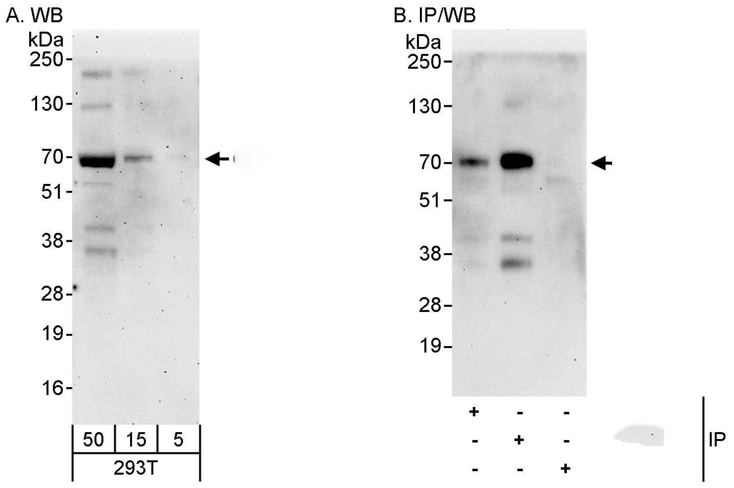 Western Blot:[NBP3-30090]-Detection of human CDC7 by western blot and immunoprecipitation. Samples: Whole cell lysate from HEK293T cells. Antibodies: Affinity purified rabbit anti-CDC7 antibody used for WB at 0. 1 µg/ml and 1 µg/ml and used for IP at 3 µg/mg lysate. CDC7 was also immunoprecipitated by rabbit anti-CDC7 antibody BL7390, which recognizes an upstream epitope. Detection: Chemiluminescence with exposure times of 3 minutes and 30 seconds.