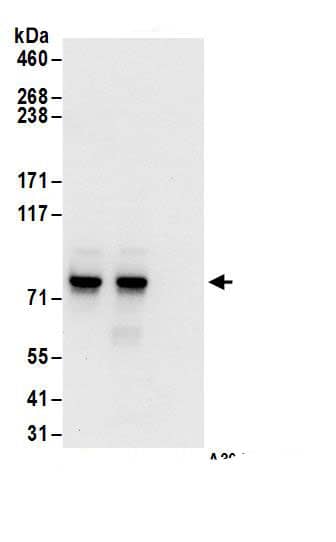 Immunoprecipitation:c-Myb AntibodyNBP3-30091] -Detection of human c-Myb by western blot of immunoprecipitates. Samples: Whole cell lysate (1 mg for IP; 20% of IP loaded) from MOLT-4 cells. Antibodies: Affinity purified rabbit anti-c-Myb antibody NBP3-30091 (lot NBP3-30091-1) used for IP at 6 µg/mg lysate. c-Myb was also immunoprecipitated by rabbit anti-c-Myb.. For blotting immunoprecipitated c-Myb, NBP3-30091 was used at 0.4 µg/ml. Detection: Chemiluminescence with an exposure time of 10 seconds.