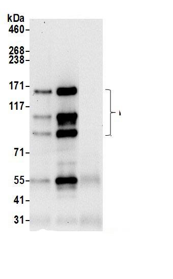 Immunoprecipitation:PLC-beta 3 AntibodyNBP3-30092] -Detection of human PLCB3 by western blot of immunoprecipitates. Samples: Whole cell lysate (0.5 or 1.0 mg per IP reaction; 20% of IP loaded) from HeLa cells prepared using NETN lysis buffer. Antibodies: Affinity purified rabbit anti-PLCB3 antibody NBP3-30092 (lot NBP3-30092-1) used for IP at 6 µg per reaction. PLCB3 was also immunoprecipitated by rabbit anti-PLCB3 antibody. For blotting immunoprecipitated PLCB3, NBP3-30092 was used at 1 µg/ml. Detection: Chemiluminescence with an exposure time of 30 seconds.
