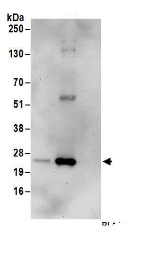 Immunoprecipitation:UBE2K/E2-25K AntibodyNBP3-30093] -Detection of human E2-25K by western blot of immunoprecipitates. Samples: Whole cell lysate (1 mg for IP; 20% of IP loaded) from 293T cells. Antibodies: Affinity purified rabbit anti-E2-25K antibody NBP3-30093 (lot NBP3-30093-1) used for IP at 6 µg/mg lysate. E2-25K was inefficiently immunoprecipitated by rabbit anti-E2-25K antibody BL14896. For blotting immunoprecipitated E2-25K, NBP3-30093 was used at 0.4 µg/ml. Detection: Chemiluminescence with an exposure time of 30 seconds.