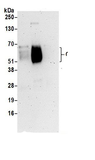 Immunoprecipitation:CD48/SLAMF2 AntibodyNBP3-30094] -Detection of human CD48 by western blot of immunoprecipitates. Samples: Whole cell lysate (1 mg for IP; 20% of IP loaded) prepared using NETN buffer from Jurkat cells. Antibodies: Affinity purified rabbit anti-CD48 antibody NBP3-30094 (lot NBP3-30094-1) used for IP at 6 µg per reaction. CD48 was inefficiently immunoprecipitated by rabbit anti-CD48 antibody BL16585. For blotting immunoprecipitated CD48, NBP3-30094 was used at 1 µg/ml. Detection: Chemiluminescence with an exposure time of 3 minutes.