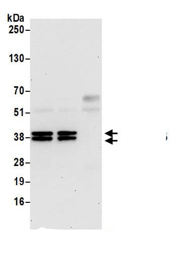 Immunoprecipitation:VTA1 AntibodyNBP3-30095] -Detection of human VTA1/LIP5 by western blot of immunoprecipitates. Samples: Whole cell lysate (0.5 or 1.0 mg per IP reaction; 20% of IP loaded) from 293T cells prepared using NETN lysis buffer. Antibodies: Affinity purified rabbit anti-VTA1/LIP5 antibody NBP3-30095 (lot NBP3-30095-1) used for IP at 6 µg per reaction. VTA1/LIP5 was also immunoprecipitated by rabbit anti-VTA1/LIP5.. For blotting immunoprecipitated VTA1/LIP5, NBP3-30095 was used at 1 µg/ml. Detection: Chemiluminescence with an exposure time of 30 seconds.