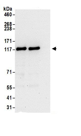 Immunoprecipitation:LUZP1 AntibodyNBP3-30097] -Detection of human LUZP1 by western blot of immunoprecipitates. Samples: Whole cell lysate (0.5 or 1.0 mg per IP reaction; 20% of IP loaded) from 293T cells prepared using NETN lysis buffer. Antibodies: Affinity purified rabbit anti-LUZP1 antibody NBP3-30097 (lot NBP3-30097-1) used for IP at 6 µg per reaction. LUZP1 was also immunoprecipitated by rabbit anti-LUZP1 antibody BL17726. For blotting immunoprecipitated LUZP1, NBP3-30097 was used at 1 µg/ml. Detection: Chemiluminescence with an exposure time of 30 seconds.