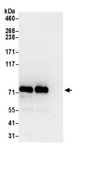 Immunoprecipitation:GTP-binding protein 1 AntibodyNBP3-30098] -Detection of human GTPBP1 by western blot of immunoprecipitates. Samples: Whole cell lysate (0.5 or 1.0 mg per IP reaction; 20% of IP loaded) from 293T cells prepared using NETN lysis buffer. Antibodies: Affinity purified rabbit anti-GTPBP1 antibody NBP3-30098 (lot NBP3-30098-1) used for IP at 6 µg per reaction. GTPBP1 was also immunoprecipitated by rabbit anti-GTPBP1.. For blotting immunoprecipitated GTPBP1, NBP3-30098 was used at 0.4 µg/ml. Detection: Chemiluminescence with an exposure time of 30 seconds.