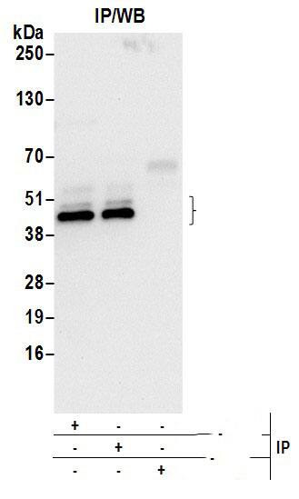 Immunoprecipitation:[NBP3-30100]-Detection of human Arfaptin-1 by western blot of immunoprecipitates. Samples: Whole cell lysate from HeLa cells prepared using NETN lysis buffer. Antibodies: Affinity purified rabbit anti-Arfaptin-1 antibody used for IP at 6 µg per reaction. Arfaptin-1 was also immunoprecipitated by rabbit anti-Arfaptin-1 antibody. For blotting immunoprecipitated Arfaptin-1, was used at 1 µg/ml. Detection: Chemiluminescence with an exposure time of 10 seconds.