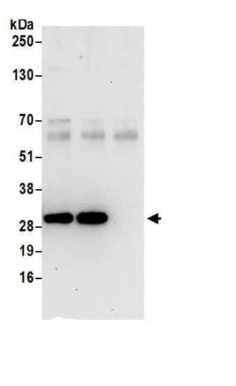Immunoprecipitation SMAP Antibody - BSA Free