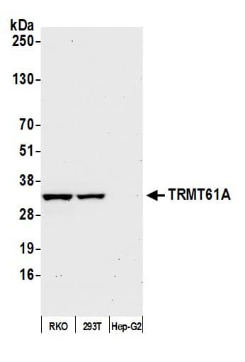 Western Blot:[NBP3-30103]-Detection of human TRMT61A by western blot. Samples: Whole cell lysate from RKO, HEK293T, and Hep-G2 cells prepared using NETN lysis buffer. Antibody: Affinity purified Rabbit antibody used for WB at 0. 1 mg/ml. Detection: Chemiluminescence with an exposure time of 30 seconds.