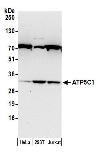 Western Blot:[NBP3-30104]-Detection of human ATP5C1 by western blot. Samples: Whole cell lysate from HeLa, HEK293T, and Jurkat cells. Antibody: Affinity purified rabbit anti-ATP5C1 antibody used for WB at 0. 1 µg/ml. Detection: Chemiluminescence with an exposure time of 30 seconds.