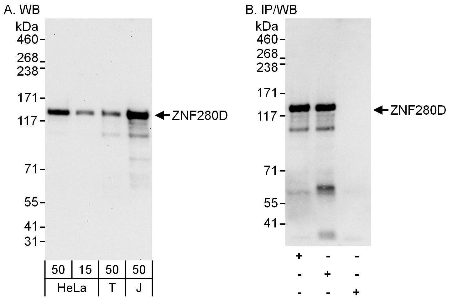Western Blot:[NBP3-30105]-Detection of human ZNF280D by western blot and immunoprecipitation. Samples: Whole cell lysate from HeLa , HEK293T and Jurkat cells. Antibodies: Affinity purified rabbit anti-ZNF280D antibody used for WB at 0. 1 µg/ml and 1 µg/ml and used for IP at 6 µg/mg lysate. ZNF280D was also immunoprecipitated by rabbit anti-ZNF280D antibody , which recognizes an upstream epitope. Detection: Chemiluminescence with exposure times of 30 seconds and 10 seconds.