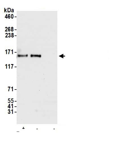 Immunoprecipitation:ORP150/HSP12A AntibodyNBP3-30107] -Detection of human ORP150/HYOU1 by western blot of immunoprecipitates. Samples: Whole cell lysate (1.0 mg per IP reaction; 20% of IP loaded) from HeLa cells prepared using NETN lysis buffer. Antibodies: Affinity purified rabbit anti-ORP150/HYOU1 antibody (NBP3-30107 lot 1) used for IP at 1 µg per reaction. ORP150/HYOU1 was also immunoprecipitated by a second.inst a different epitope of ORP150/HYOU1 (BL19596). For blotting immunoprecipitated ORP150/HYOU1, NBP3-30107 was used at 0.04 mg/ml. Detection: Chemiluminescence with an exposure time of 10 seconds.