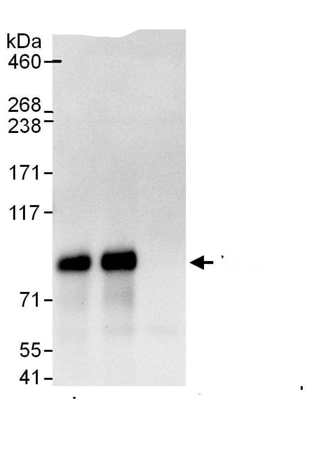 Immunoprecipitation:BUD13 AntibodyNBP3-30108] -Detection of human BUD13 by western blot of immunoprecipitates. Samples: Whole cell lysate (1 mg for IP, 20% of IP loaded) from HeLa cells. Antibodies: Affinity purified rabbit anti-BUD13 antibody NBP3-30108 used for IP at 6 µg/mg lysate. BUD13 was also immunoprecipitated by rabbit anti-BUD13., which recognizes a downstream epitope. For blotting immunoprecipitated BUD13, was used at 1 µg/ml. Detection: Chemiluminescence with an exposure time of 10 seconds.