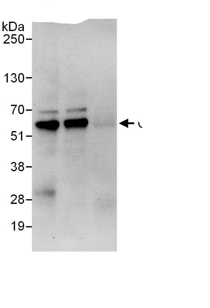 Immunoprecipitation:C18orf25 AntibodyNBP3-30109] -Detection of human C18orf25 by western blot of immunoprecipitates. Samples: Whole cell lysate (1 mg for IP, 20% of IP loaded) from HeLa cells. Antibodies: Affinity purified rabbit anti-C18orf25 antibody NBP3-30109 used for IP at 6 µg/mg lysate. C18orf25 was also immunoprecipitated by rabbit anti-C18orf25., which recognizes a downstream epitope. For blotting immunoprecipitated C18orf25, NBP3-30109 was used at 1 µg/ml. Detection: Chemiluminescence with an exposure time of 30 seconds.